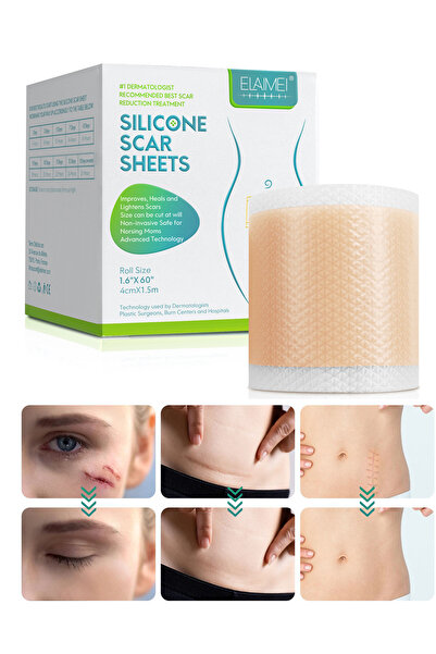 ELAIMEI Silicone Scar Tape Roll, Scar Care, Gentle on Skin, Lightweight, Dail...