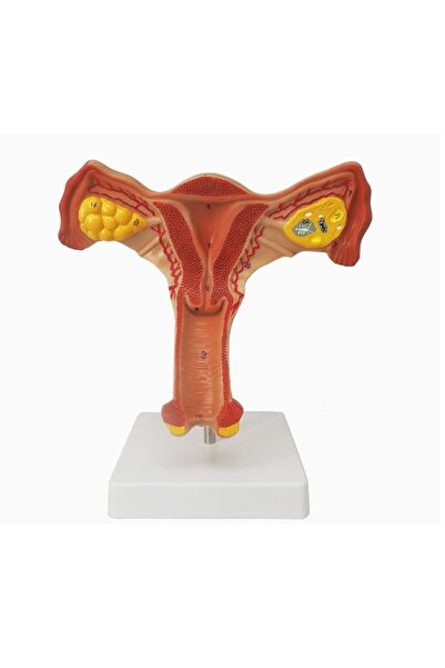EgeAnatomi Maketleri Uterus Maketi - (Uterus Modeli)
