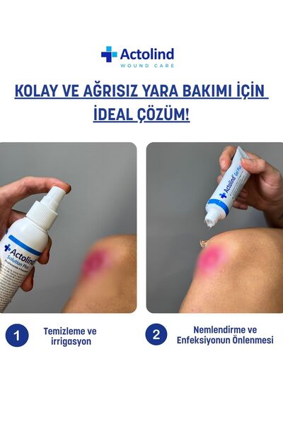 Actolind Solution Plus 250 ml Yara Bakım Solüsyonu