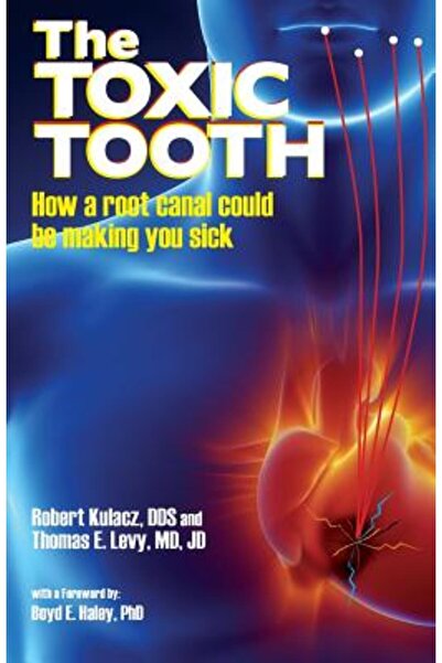 INDEPENDENT CAT Dintele toxic: Cum te-ar putea îmbolnăvi un tratament de canal