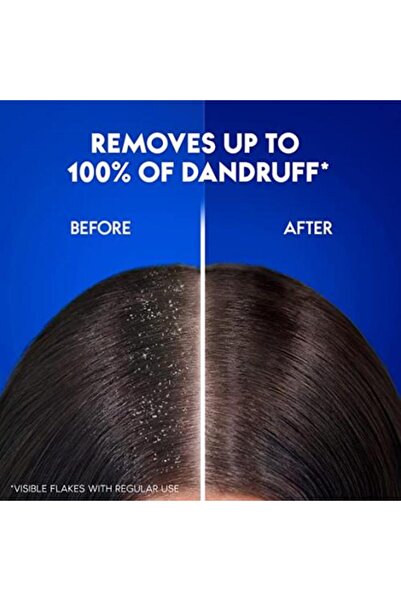 Head & Shoulders Anti-Dandruff Shampoo with Citrus Freshness 600ml
