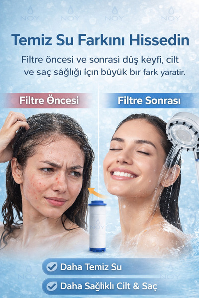 NOY Filtreli Duş Başlığı UYUMLU Yedek Filtresi Kireç Kir Pas Önleyici 5 Adet