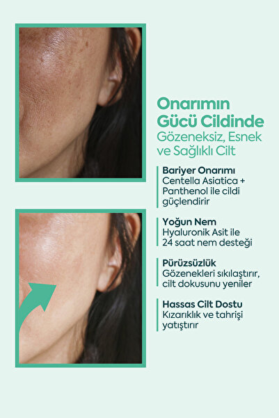 Clasy Care Face Up Skin Gözenek Sıkılaştırıcı, Onarıcı, Kırışıklık Karşıtı Cilt Kremi 40ml