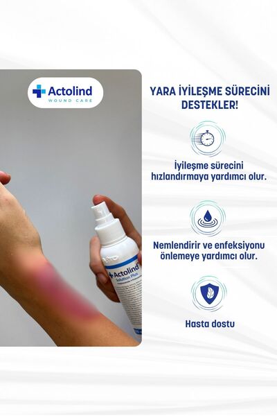 Actolind Solution Plus 250 ml Yara Bakım Solüsyonu