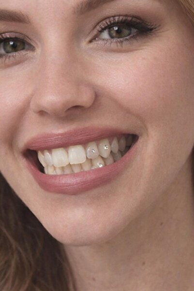 New Obsessions Zirkon Yapıştırma Diş Taşı