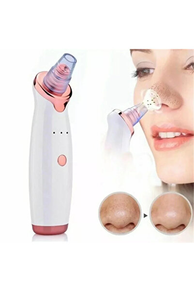 VLK Şarjlı Siyah Nokta Temizleme Cihazı 5 Başlıklı (5047) VLK