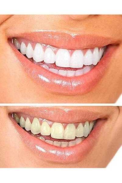 OPALESCENSE Original Opal Sense Teeth Whitening Gel, Professional Whitening Strength, 20% Concentration, Mint Flavor - 8 Tubes, Green