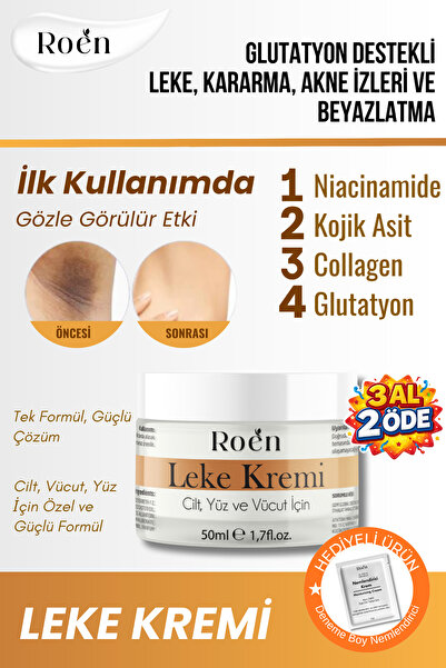 Roen Cilt Beyazlatıcı, Leke Kremi, Kararma, Akne, Güneş Lekeleri, Glutatyonlu...
