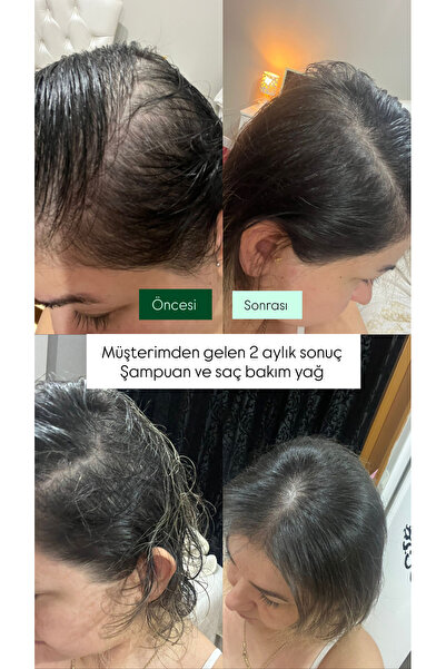 ANYSİA NATURAL Besleyici&Nemlendirici Doğal Şampuan
