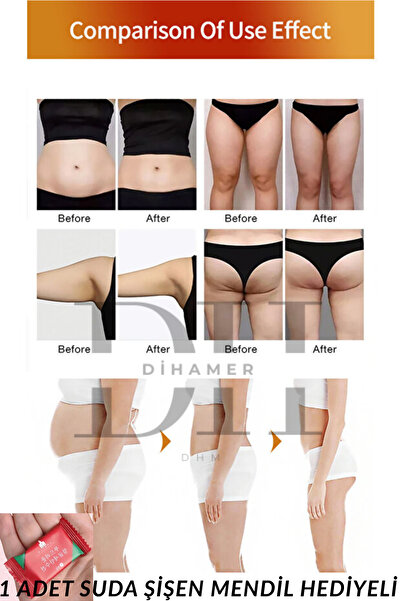 Dihamer Patch Göbek Bandı Patch Göbek 30 Adet(1 ADET SUDA ŞİŞEN MENDİL HEDİYELİ)