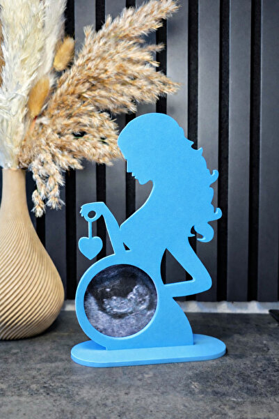 Vescarri Ultrasound Photo Frame – Keepsake Decor for Expecting Mothers