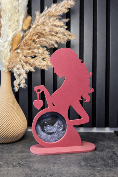 Vescarri Ultrasound Photo Frame – Keepsake Decor for Expecting Mothers