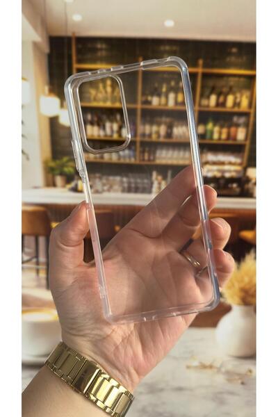 Vip Case Redmi note 10 pro compatible transparent shock absorbing camera prot...