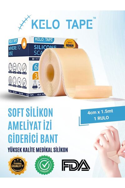 Kelo Tape Soft Silikon Bant Estetik Keloid Yanık Sezaryen Dikiş Ameliyat Izi ...