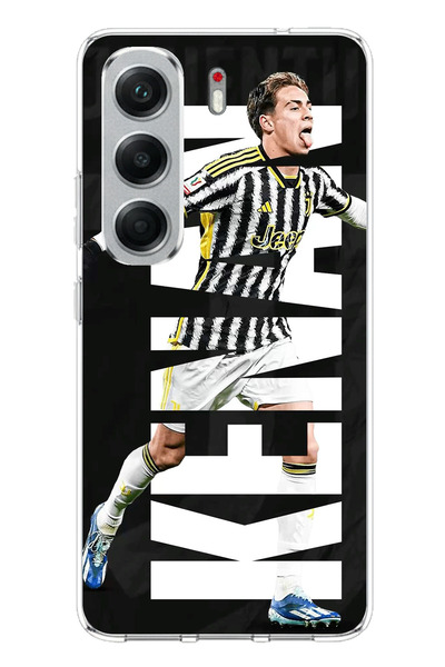 TechTree Tecno Camon 40 Compatible Kenan Yıldız Joy Printed Silicone Case