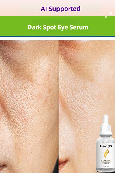 Devida سلسلة فيفو A210 لتضييق المسام وإزالة الرؤوس السوداء