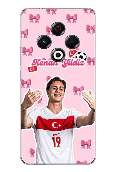 TechTree حافظة سيليكون متوافقة مع تكنو سبارك 30 كينان يلدز كورديل مطبوع