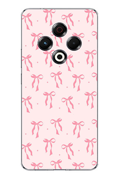 TechTree حافظة سيليكون مطبوعة بنمط فيونكة وردية ناعمة متوافقة مع تكنو سبارك 30