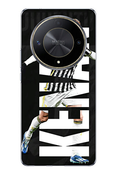 TechTree Honor X9B Compatible Kenan Yıldız Sevinç Printed Silicone Case