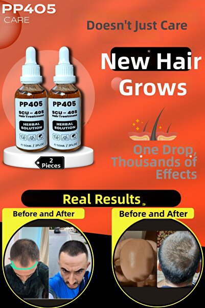 pp405 Hair Growth and Strengthening Serum Anti-Baldness Fast Hair Growth for ...