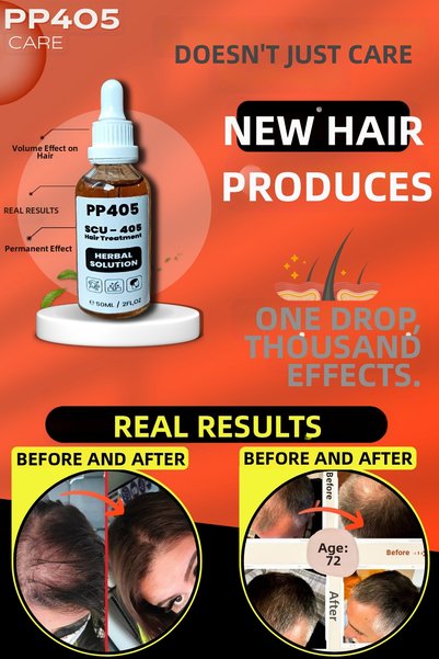pp405 Hair Growth and Strengthening Serum Anti-Baldness Fast Hair Growth for Bald Areas - 1 Piece