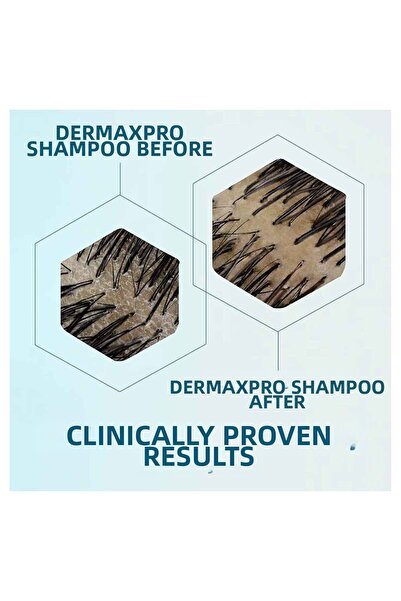 Head & Shoulders Dermaxpro Scalp & Hair Revitaliser Anti-Hair Loss and Anti-Dandruff Shampoo with Caffeine and Ceramide 300 ml