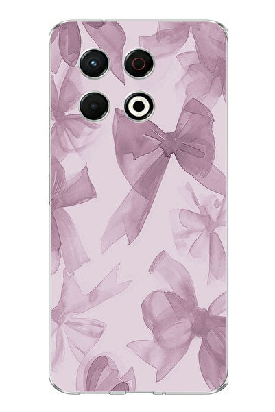 TechTree حافظة سيليكون متوافقة مع تكنو سبارك 30 برو بلون فيوليت مطبوع