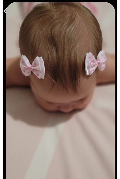 LO ADORO 2 Pieces Hairless Doll Bow Hairpin Fence Hairpin Hair Accessory for ...