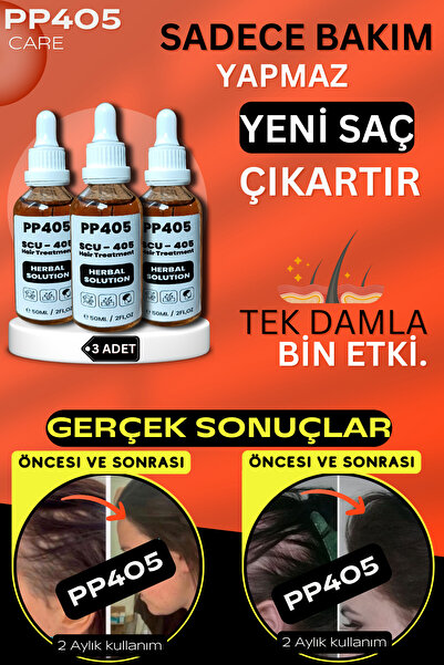 pp405 Profesyonel Saç Çıkartıcı Bakım Serumu - Kökü Oluşturucu ve Yoğun Gürle...