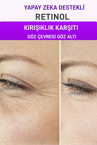 Devida Kırışıklık Karşıtı Serum Göz Çevresi ve Kaz Ayağı Alın Çizgileri Retin...