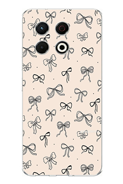 TechTree حافظة سيليكون متوافقة مع هاتف Tecno Spark 30 Pro باللون الأسود بنمط ...