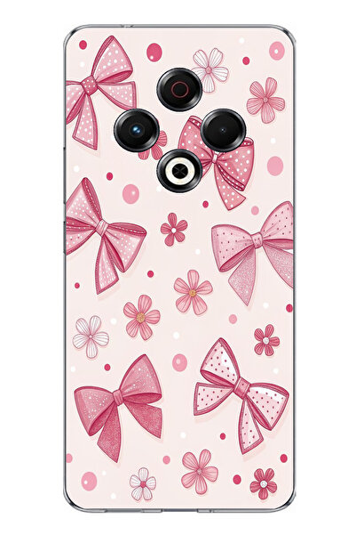 TechTree حافظة سيليكون متوافقة مع تكنو سبارك 30، وردية اللون، على شكل فيونكة،...