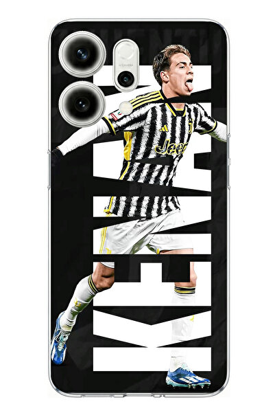 TechTree Oppo Reno 14 5g Compatible Kenan Yıldız Sevinç Printed Silicone Case