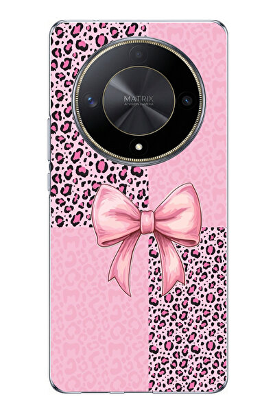 TechTree حافظة سيليكون متوافقة مع Honor X9B بنمط الفهد الوردي وشريط مطبوع