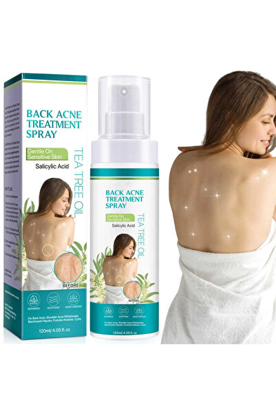 NOVA KISS Spray anti-acneic pentru spate și corp cu ingrediente care reduce c...