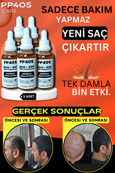 pp405 Saç Çıkartıcı Saç Gürleştirici Dökülme Karşıtı Anti-Hair Loss Oluşumu S...