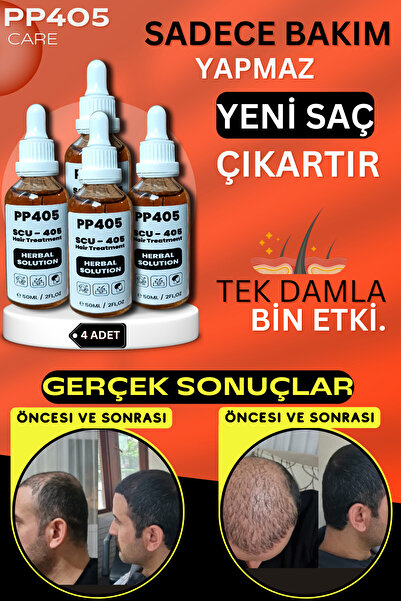 pp405 Saç Çıkartıcı ve Gürleştirici Serum Kellik Karşıtı Kel Bölgeler İçin Hı...