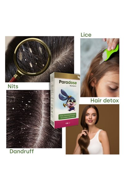 UBM Paradose Clarifying Shampoo For Lice, Dandruff, Oils (Kids, Adults & Pets), Natural French Formula