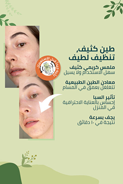 Clasy Care قناع الطين (قناع الطين الكلاسيكي)