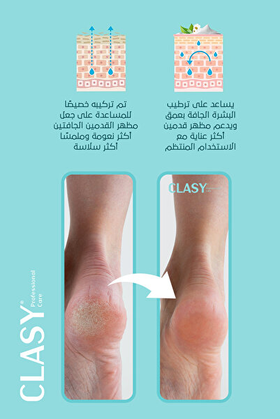 Clasy Care كريم تشققات القدم والكعب، العناية بالقدم، رائحة القدم والكعب 100 مل