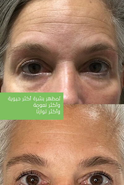 Clasy Care قناع جل الصبار - قناع جل مجدد