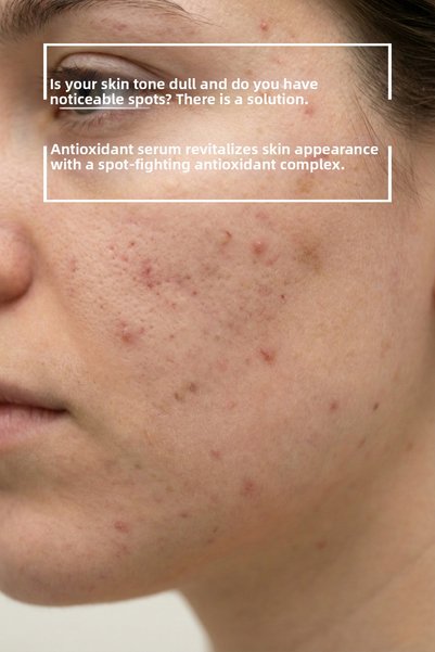 OMORFİA Anti-Blemish Antioxidant Complex Care Serum 30 ml