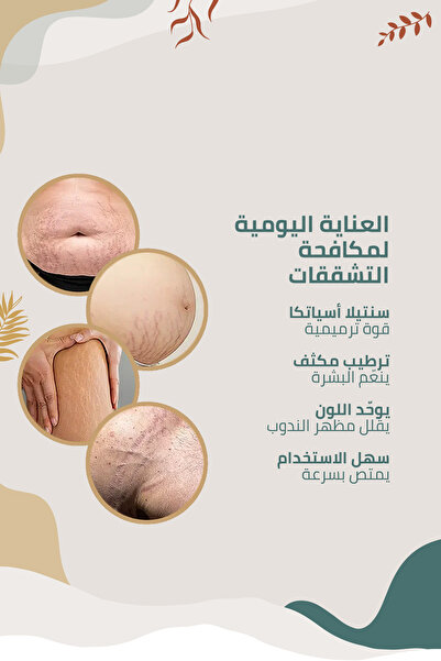 Clasy Care كريم ممتاز لتقليل ظهور الندبات وعلامات التمدد والوقاية منها