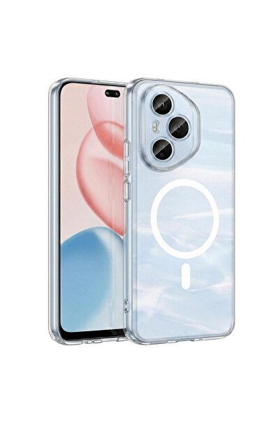 Microsonic Honor 400 Pro Kılıf MagSafe Clear Sararmaz Şeffaf