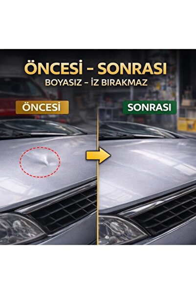 coofbe Profesyonel Boyasız Göçük Düzeltme Seti 20 Parça Kaporta Çektirme Göçük Düzeltici Kaput Kapı