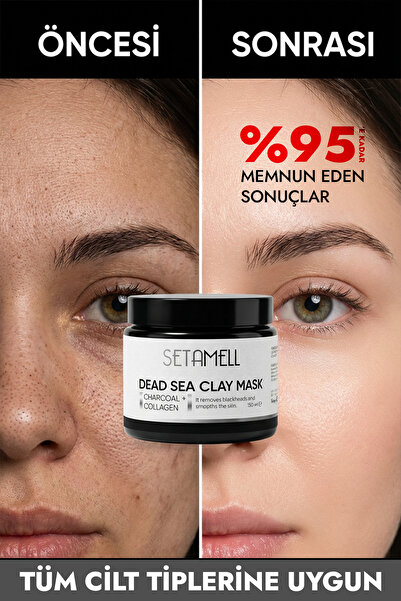 Setamell Ölü Deniz Maskesi Kolejenli Siyah Nokta Sivılce Ve Yaslanma - Karşıt...