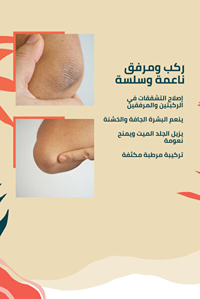 Clasy Care كريم العناية بالركبة والمرفقين - ضد الجلد المتشقق والجاف والداكن والمتصلب (كريم إصلاح الشقوق من كلاسي)