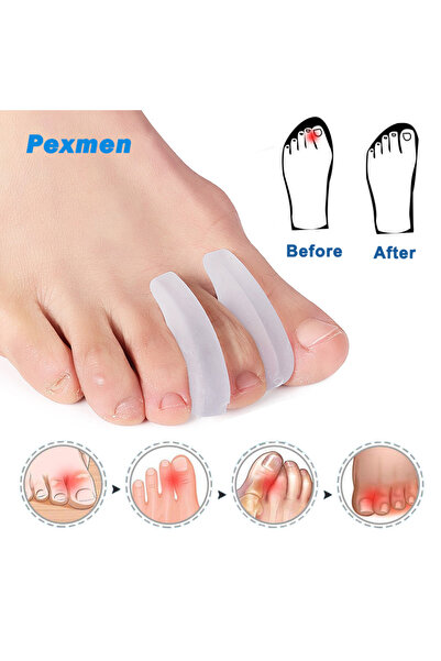 Choice M-4Pcs-for 2nd-4th Pexmen 2/4Pcs Gel Toe Separators for Bunion Pain Re...