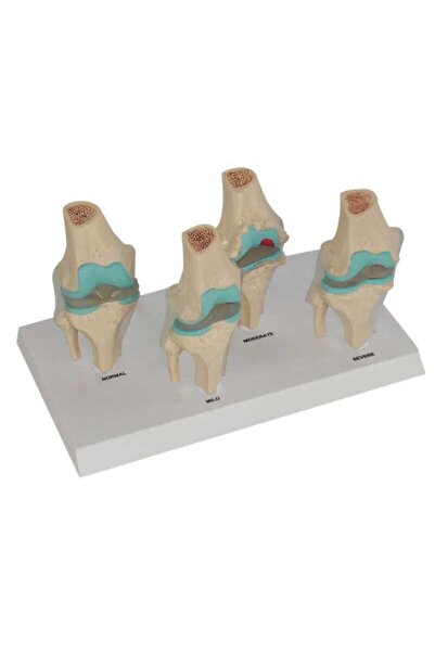 TeTea Anatomy Cast of the Head, Human Knee and the Phases of Joint Disease in...