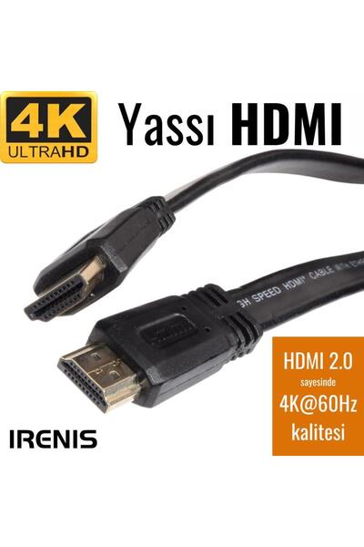 IRENIS HDMI Kablo - Yassı 4K HDMI Kablosu (4K 60Hz, HDMI 2.0) , 50 cm